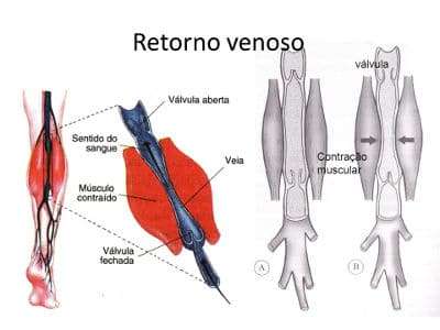 doenças cardíacas atividade física